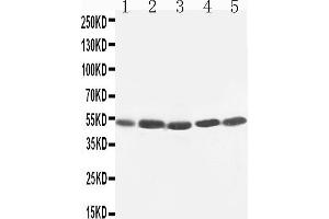 Anti-TIM 1 antibody, Western blotting Lane 1: SMMC Cell Lysate Lane 2: HELA Cell Lysate Lane 3: PANC Cell Lysate Lane 4: M231 Cell Lysate Lane 5: M453 Cell Lysate (HAVCR1 antibody  (C-Term))
