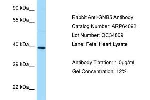 Western Blotting (WB) image for anti-Guanine Nucleotide Binding Protein (G Protein), beta 5 (GNB5) (N-Term) antibody (ABIN2789729) (GNB5 antibody  (N-Term))