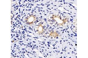Immunohistochemistry analysis of paraffin-embedded rat uterus using,TSPAN1 (ABIN7075867) at dilution of 1: 4000