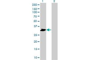 Western Blot analysis of PRPS1 expression in transfected 293T cell line by PRPS1 polyclonal antibody (A01).