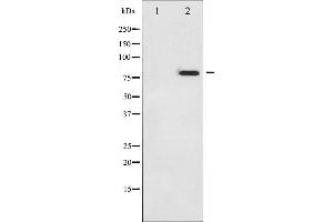 Tumor Protein p73 anticorps  (pTyr99)