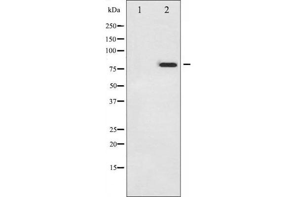 Tumor Protein p73 anticorps  (pTyr99)
