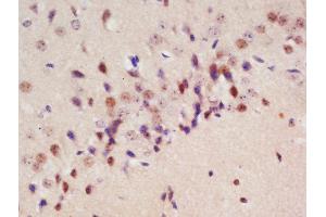 Formalin-fixed and paraffin embedded rat brain labeled with Rabbit Anti-Drebrin Polyclonal Antibody, Unconjugated (ABIN873130) at 1:200 followed by conjugation to the secondary antibody and DAB staining (DBN1 antibody  (AA 151-250))