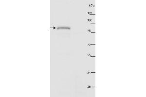 anti-PHOT2 antibody