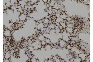 ABIN6279755 at 1/100 staining Mouse lung tissue by IHC-P. (RGS17 antibody  (N-Term))