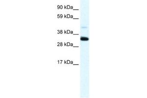 Western Blotting (WB) image for anti-Annexin A3 (ANXA3) antibody (ABIN2461372) (Annexin A3 antibody)