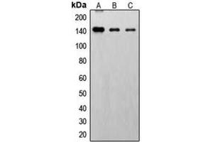 Western blot analysis of FGFR1 (pY766) expression in HepG2 EGF-treated (A), SP2/0 EGF-treated (B), PC12 EGF-treated (C) whole cell lysates.