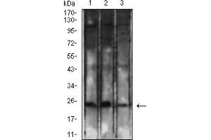 Western Blotting (WB) image for anti-CD8a Molecule (CD8A) (AA 22-235) antibody (ABIN7193490)
