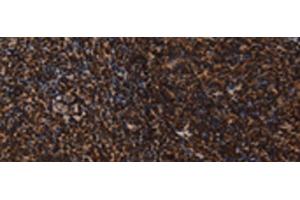 Immunohistochemistry of paraffin-embedded Human tonsil tissue using LMNB1 Polyclonal Antibody at dilution of 1:60(x200) (Lamin B1 antibody)