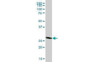 CACYBP MaxPab polyclonal antibody. (CACYBP antibody  (AA 1-228))