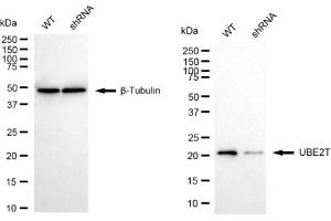 Western blotting analysis using UBE2T antibody (ABIN7800753). (Recombinant Ube2t antibody)