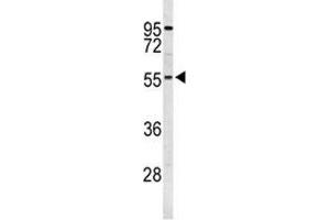 Western blot analysis of S6K2 antibody and K562 lysate.