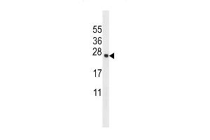 T Antibody (Center) (ABIN656855 and ABIN2846060) western blot analysis in mouse testis tissue lysates (35 μg/lane). (Transmembrane Protein 18 (TMM18) (AA 63-90) antibody)