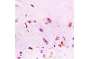Immunohistochemistry (IHC) image for anti-X-Ray Repair Complementing Defective Repair in Chinese Hamster Cells 6 (XRCC6) (C-Term) antibody (ABIN7295716)