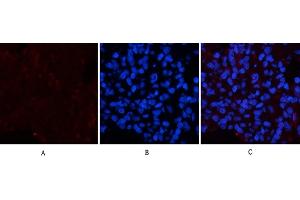 Immunofluorescence analysis of rat lung tissue. (Collagen IV antibody)