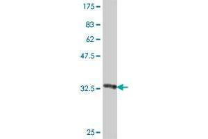 Western Blot detection against Immunogen (37 KDa) . (Netrin G2 antibody  (AA 21-119))