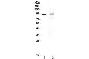 Western blot testing of 1) rat spleen and 2) mouse intestine lysate with TLR1 antibody at 0. (TLR1 antibody)