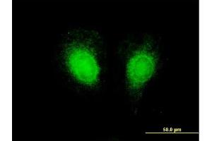Immunofluorescence of purified MaxPab antibody to CSF2 on HeLa cell. (GM-CSF antibody  (AA 1-144))