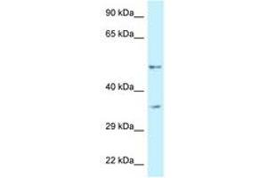 Image no. 1 for anti-6-phosphofructo-2-Kinase/fructose-2,6-Biphosphatase 1 (PFKFB1) (AA 335-384) antibody (ABIN6747350) (PFKFB1 antibody  (AA 335-384))