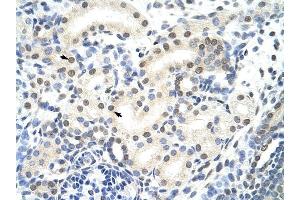 SNRP70 antibody was used for immunohistochemistry at a concentration of 4-8 ug/ml to stain Epithelial cells of renal tubule (arrows) in Human Kidney.