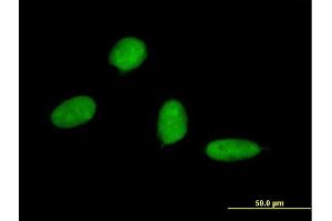Immunofluorescence of monoclonal antibody to SP7 on HeLa cell.