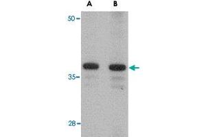 Western blot analysis of CDCA8 in rat kidney tissue lysate with CDCA8 polyclonal antibody  at (A) 1 and (B) 2 ug/mL .
