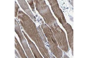 Immunohistochemical staining (Formalin-fixed paraffin-embedded sections) of human skeletal muscle with PANK4 polyclonal antibody  shows moderate cytoplasmic positivity.
