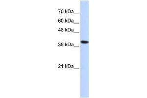 WB Suggested Anti-ATP4B Antibody Titration:  0. (ATP4b antibody  (Middle Region))