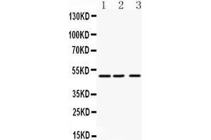 Anti- ANGPTL4 antibody, Western blotting All lanes: Anti ANGPTL4  at 0.