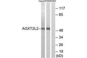 Western blot analysis of extracts from K562/HepG2 cells, using AGXT2L2 Antibody. (AGXT2L2 antibody  (AA 341-390))