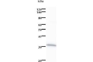 Western Blotting (WB) image for anti-Cyclin B1 Interacting Protein 1 (CCNB1IP1) antibody (ABIN931236) (CCNB1IP1 antibody)