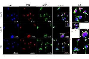 Sub-cellular localization of TERT and MMP-9 in SCCF2 and SCCF3.