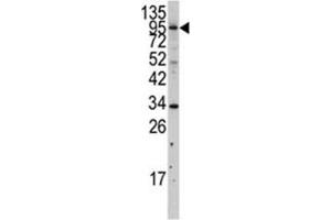 MYLK3 antibody  (AA 40-69)