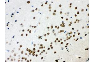 Anti- WNT2B Picoband antibody, IHC(P) IHC(P): Mouse Brain Tissue