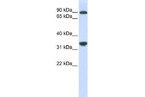 WB Suggested Anti-RRP1B Antibody Titration:  0. (RRP1B antibody  (Middle Region))