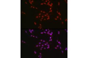 Immunofluorescence analysis of U2OS cells using CREB1 Rabbit pAb (ABIN7266053) at dilution of 1:50 (40x lens). (CREB1 antibody  (AA 1-341))