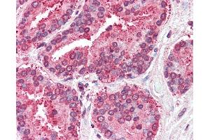 Anti-TSPAN6 antibody IHC of human prostate. (Tetraspanin 6 antibody  (Internal Region))