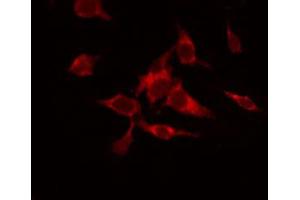 ABIN6266659 staining HuvEc by IF/ICC. (SENP7 antibody  (C-Term))