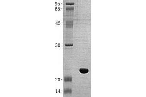 Validation with Western Blot (LSM1 Protein (His tag))