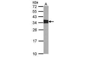 Image no. 1 for anti-V-Crk Sarcoma Virus CT10 Oncogene Homolog (Avian) (CRK) (AA 122-302) antibody (ABIN467422) (Crk antibody  (AA 122-302))
