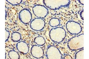 Immunohistochemistry of paraffin-embedded human stomach tissue using ABIN7146057 at dilution of 1:100 (CLEC18A antibody  (AA 27-446))