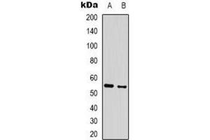 Western blot analysis of GABRA3 expression in mouse brain (A), rat brain (B) whole cell lysates. (GABRA3 antibody)
