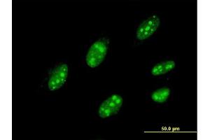 Immunofluorescence of monoclonal antibody to IQGAP3 on HeLa cell. (IQGAP3 antibody  (AA 602-698))