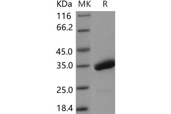 SPINK4 Protein (Fc Tag)