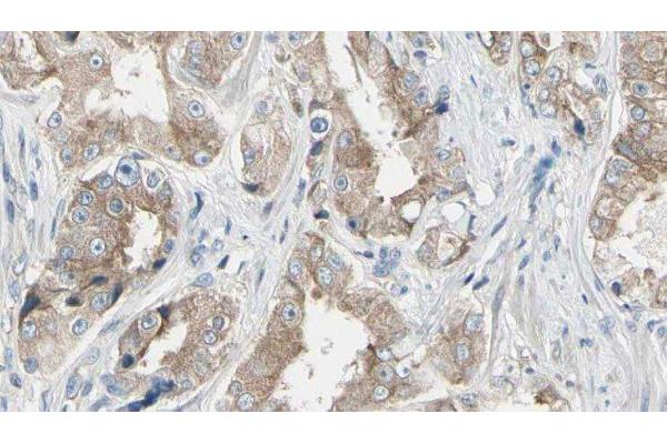 MAP3K1 antibody  (pThr1402)