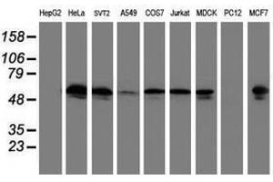 Image no. 1 for anti-Tubulin, alpha-Like 3 (TUBAL3) (AA 150-446) antibody (ABIN1490957) (TUBAL3 antibody  (AA 150-446))