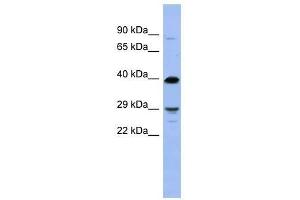 OLIG3 antibody used at 5 ug/ml to detect target protein.