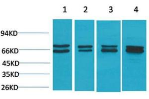 Western Blot (WB) analysis of 1) HeLa, 2)MCF7, 3) Mouse Liver Tissue, 4) Rat Liver Tissue with Estrogen Receptor a Rabbit Polyclonal Antibody diluted at 1:2000. (Estrogen Receptor alpha antibody)