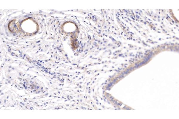 SFRP1 antibody  (AA 8-153)