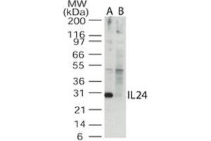 Western blot analysis of IL24 in the A) absence and B) presence of blocking peptide in Jurkat cell lysate. (IL-24 antibody  (AA 100-150))